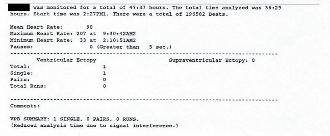 Normal holter result